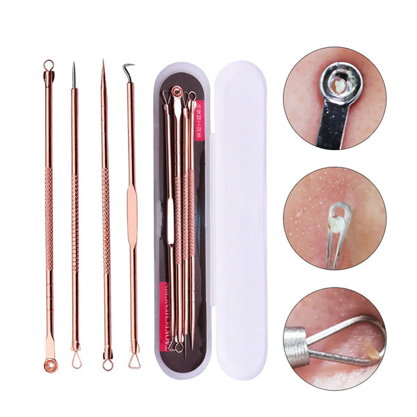 4PCS Blackhead/Acne Extractor Rose Gold Blemish Remover Needles Set Black Spots Pore Cleanser Tool