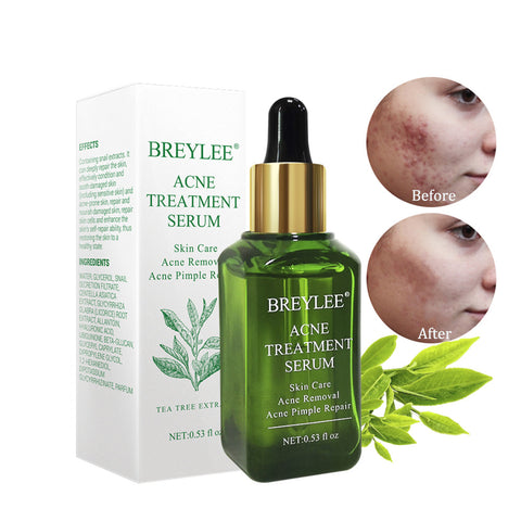 Facial Essence Anti Acne Scar Removal Cream Acne Treatment  Face Skin Care Whitening Repair Pimple Remover For blackhead Acne