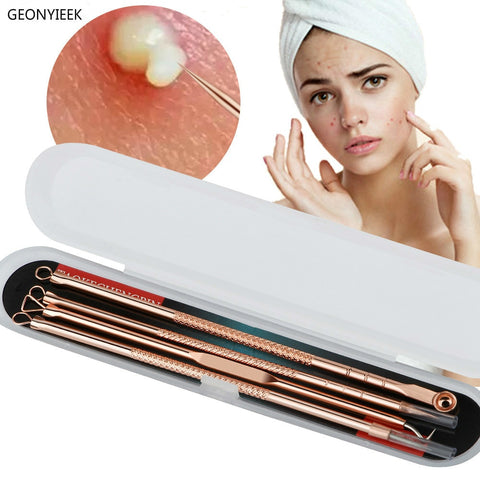 Rose Gold 4pcs/set Blackhead/Acne Remover Comedone Tool for Face Skin Care Tool