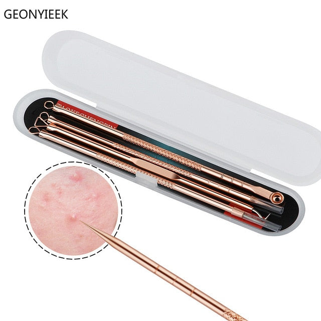 Rose Gold 4pcs/set Blackhead/Acne Remover Comedone Tool for Face Skin Care Tool